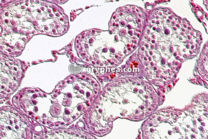 Testicule cryptorchide x100 - gryphea.com